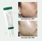 Axis-Y Dark Spot Correcting Glow SERUM - Image 4